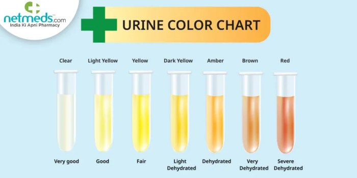 Can food coloring affect urine color