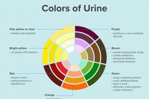 Can food coloring affect urine color